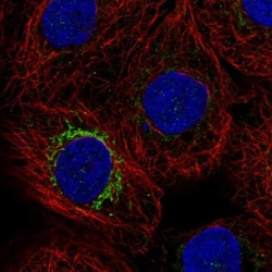 MPP2 Antibody, Novus Biologicals 25 &mu;L; Unlabeled:Antibodies, Polyclonal